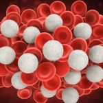 Causes and Results of High White Blood Cells